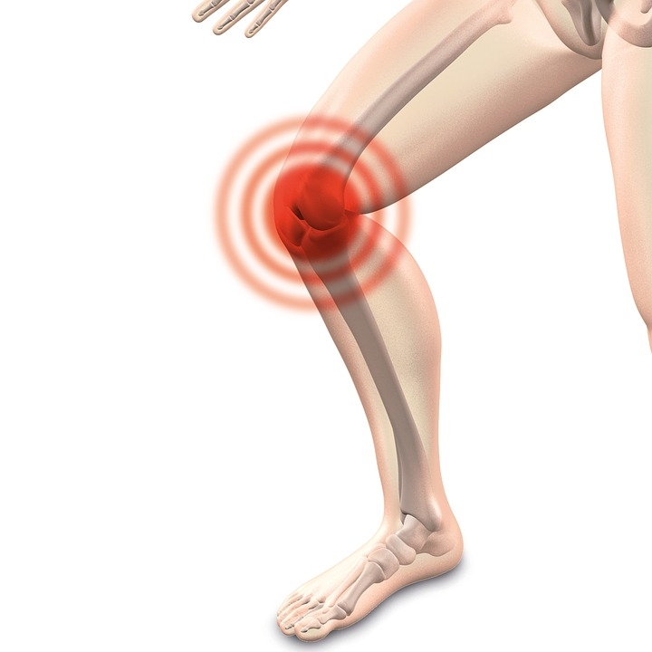 Fisioterapia Roma Intervento al ginocchio - cosa dobbiamo aspettarci?