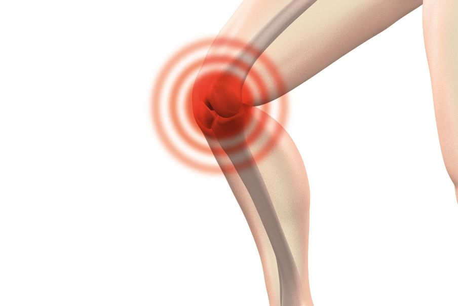 Fisioterapia Roma Esercizi di rafforzamento del ginocchio