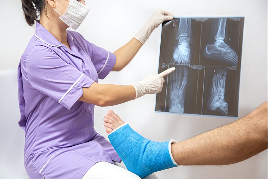 Fisioterapia a Roma La pseudoartrosi
