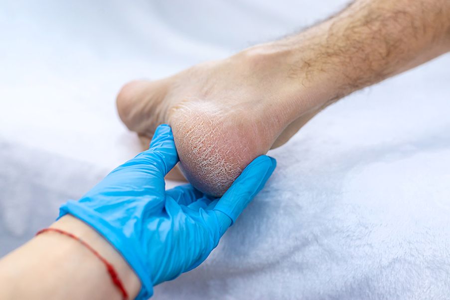 Fisioterapia a Roma La tallonite